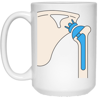 Shoulder Replacement: Plain