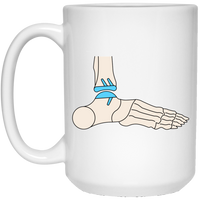 Ankle Replacement: Plain